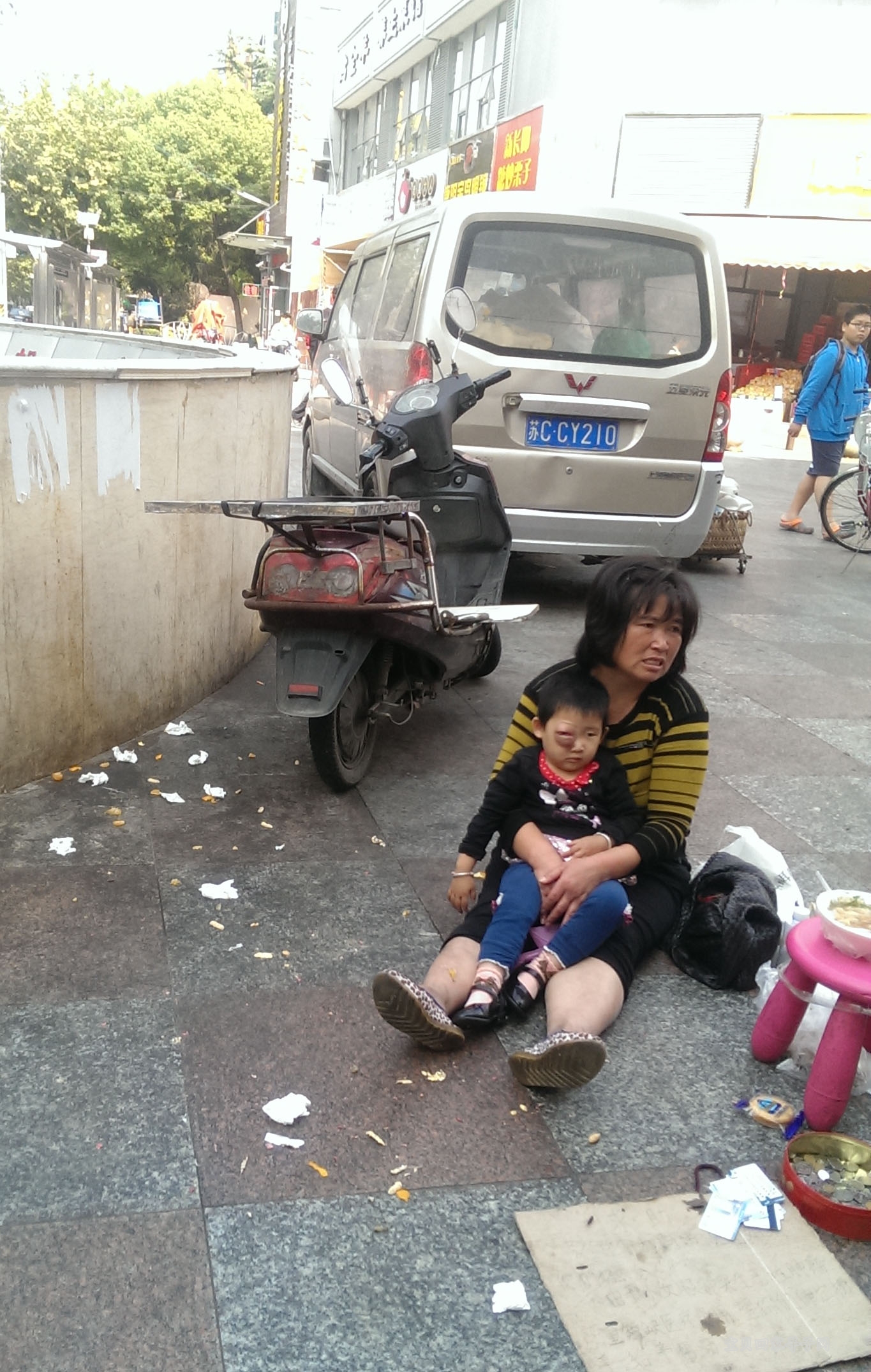 小孩子眼睛是肿的