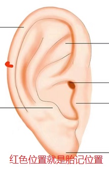 耳朵胎记位置